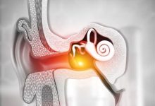 Orta Kulak İltihabı