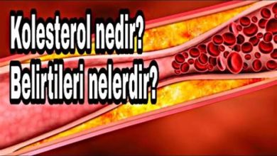 Kolesterol Yüksekliği Nedir? Belirtileri Nelerdir?