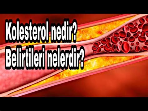 Kolesterol Yüksekliği Nedir? Belirtileri Nelerdir?