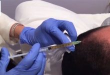 PRP Tedavisi Nedir? Kimlere Uygulanabilir?