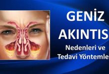 Geniz Akıntısı Neden Olur? Nasıl Geçer?